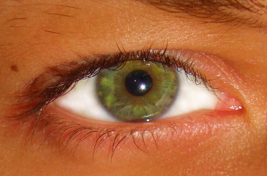Опасные диагнозы при ощущении песка или инородного тела в глазах: глаукома и конъюнктивит 